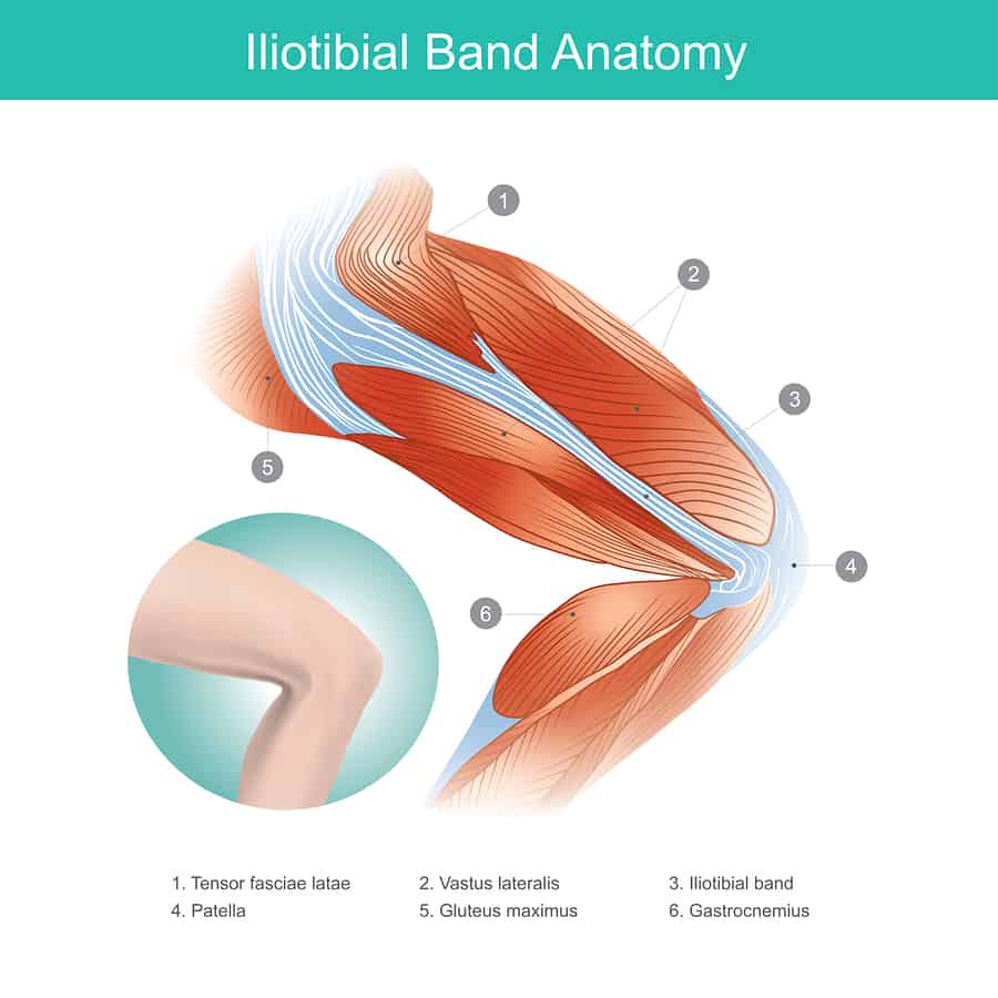 cartoon anatomy drawing of the iliotibial band as an illustration for an article about how to stretch the it band
