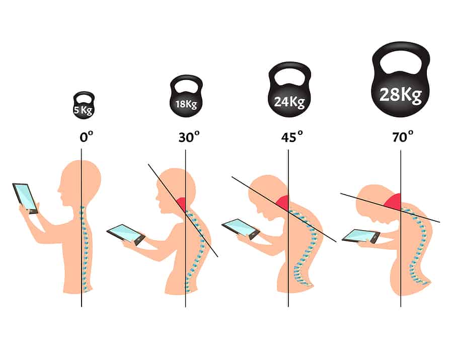 cartoon illustration of the weight of the head at different forward head angles and how it relates to text neck